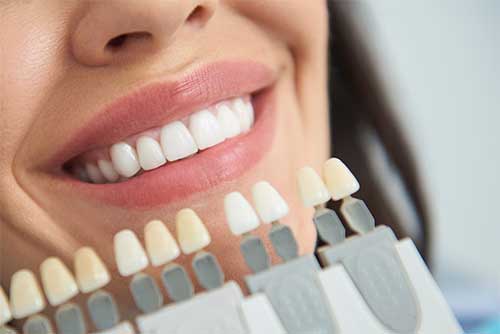 dentist comparing different shades of tooth colors to a woman with white teeth.